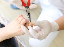 足のケア アンド 巻き爪 エムズ 白金通り店(M's)/巻き爪矯正2