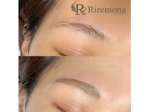 リルモナ(RIREMONA)/