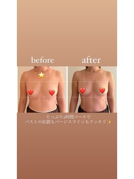 ウララカ(uraraka)/