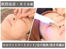 アール(R)