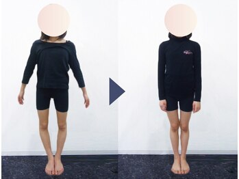 美デザイン 川越店(美.design)/☆美脚O脚矯正+美尻骨盤矯正