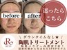 【リピーター様】REVI最高峰ケア☆ハーブピーリング＋IPSP美容液導入でハリ艶