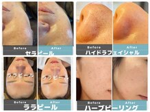 エスサロン(S.salon)