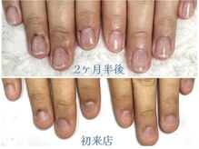 グラシナ 鳥丸店/3、4回でここまで変わります