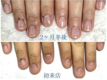 グラシナ 鳥丸店/3、4回でここまで変わります