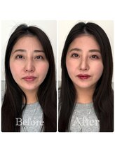 シャルム(Sharme)/お客様Before→After