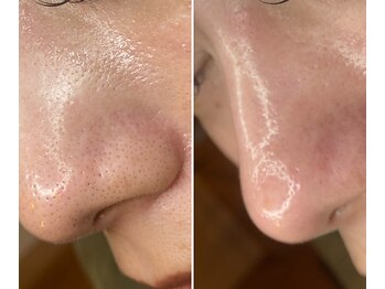 サイ(Sai)/before⇒after