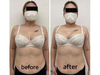 ベルファム(BelleFemme)/バストアップ/バストケア/育乳