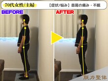 幸せのもり整体院/【70代女性】Mさん