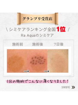 ポノ(pono)/シミケア　先生グランプリ獲得