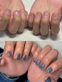 パズルリングネイル(Puzzle.ring Nail)/メンズ深爪スカルプ