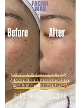 エリス(ELISSE)/お肌改善の近道はFACIAL WAX