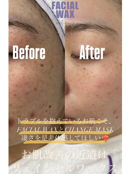 エリス(ELISSE)/お肌改善の近道はFACIAL WAX