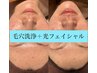 【ハイドロフェイシャル＋光フェイシャル＋高保湿パック】12,500円→10,000円