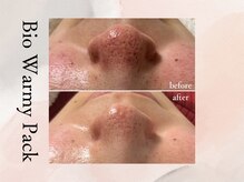 ビシア(Bicia)/松ヤニパック