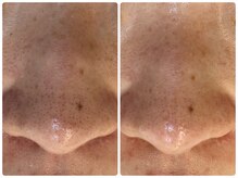 サイセイ(SAISEI)/