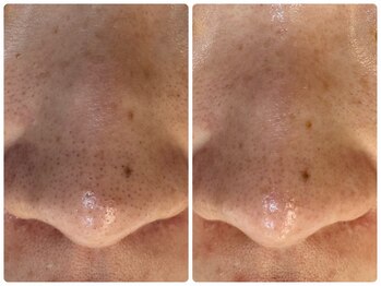 サイセイ(SAISEI)/