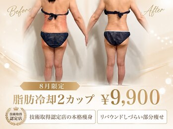 リペア 平尾店(repair)の写真/落ちにくい二の腕・背中の脂肪に集中アプローチ!リバウンドしにくい脂肪冷却!寝たままで理想のボディへ♪