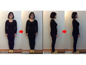 整体院プラス/全身スタイル矯正モニター