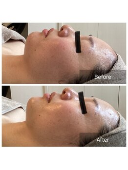 ソルーチェ(soluce)/フェイシャルマッサージ♪