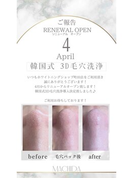 ホワイトニングショップ 町田店/【韓国式3D毛穴洗浄】大注目
