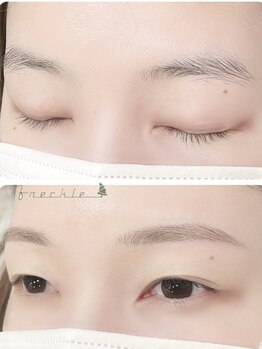 フレックル(freckle)/似合わせ美眉スタイリング