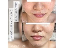 ウィラレア(UILALEA)の雰囲気（肌悩みに合わせて仕上げのパックをセレクト）