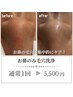 お鼻のみ徹底毛穴洗浄☆1回¥5500！！