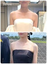 ヒーリングサロン ケリー(KELLY)/お客様　ビフォーアフター