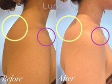 ルノン(Lunon)/【巻き肩/肩こり】肩甲骨はがし