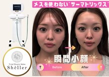 シェリエ(Sheller)