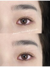 アミーラ(Amira)/フラットラッシュ