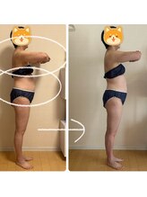 高槻 インサイド(Inside)/ビフォー・アフター