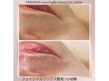 マカナ(MAKANA)の雰囲気（フェイシャルワックス脱毛☆ごっそり産毛、角質を除去しうる艶肌）