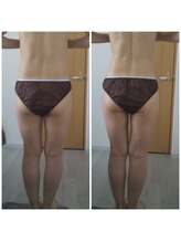 キュアボディ(Cure Body)/美容整体１回施術