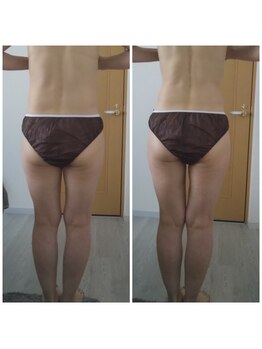 キュアボディ(Cure Body)/美容整体1回施術