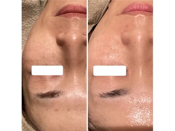 サロン リア(Salon Li’a)/お客様のビフォーアフター