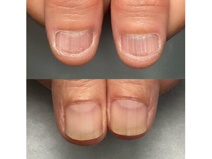 カラー(calla)の写真