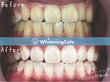 ホワイトニングカフェ 葛西店(WhiteningCafe)