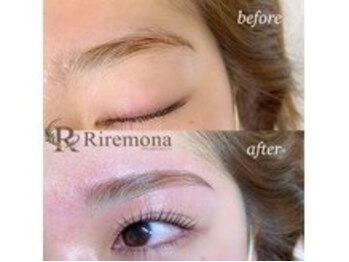 リルモナ(RIREMONA)/