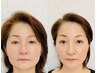 【当店イチオシ♪】超小顔術！ご新規様限定小顔造形マシン体験コース