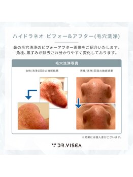 サンテ(Sante)/ハイドラフェイシャル