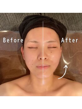 小顔フェイスラボ 大津京駅前店(小顔 Face Labo.)/小顔&整体コルギの変化