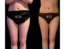 エードット(A.)/３ヶ月後