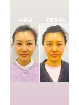 赤沼鍼灸整骨院/美・健康・笑顔に導く美容鍼