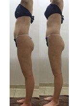 エステティック レイビス 池袋店(RAYVIS)/骨盤ケア