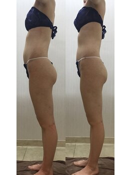 エステティック レイビス 池袋店(RAYVIS)/骨盤ケア