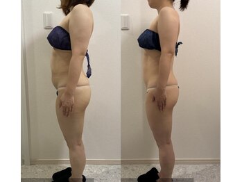 モア 鈴鹿(more)の写真/皮下脂肪×固太り×セル脂肪にアプローチする痩身技術と筋肉への刺激で引き締めBODYへ★
