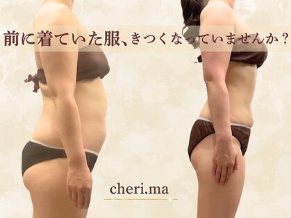 シェリマ 西新宿(cheri.ma)の写真