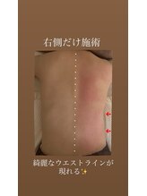 ウララカ(uraraka)/